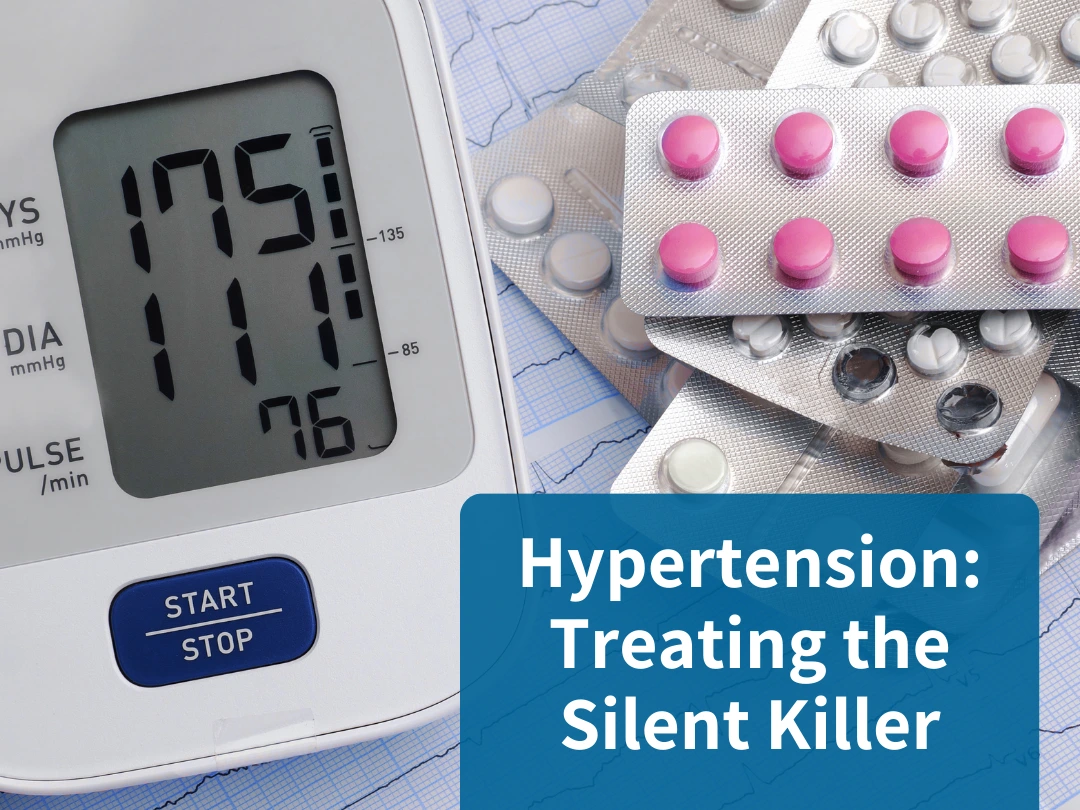 Treating the Silent Killer: Hypertension Insights and Solutions